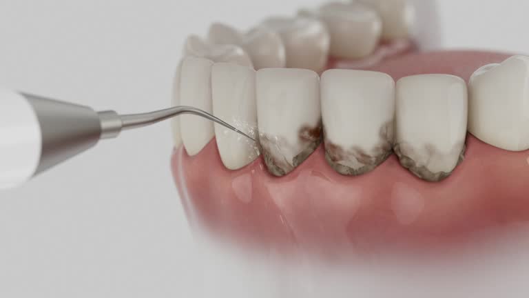 Trusted Wisdom Tooth Removal service in Clinton, LA - Dentist Open Now
